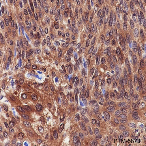Anti-MEK1 Rabbit mAb
