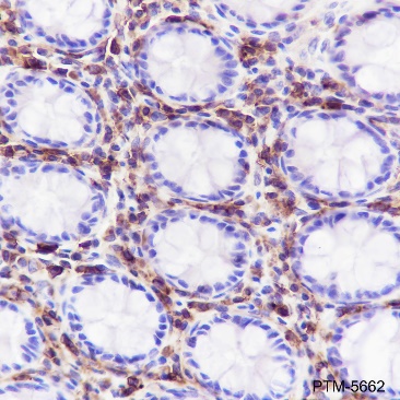 Anti-CD38 Rabbit mAb