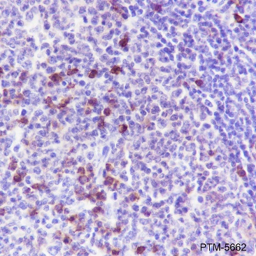 Anti-CD38 Rabbit mAb