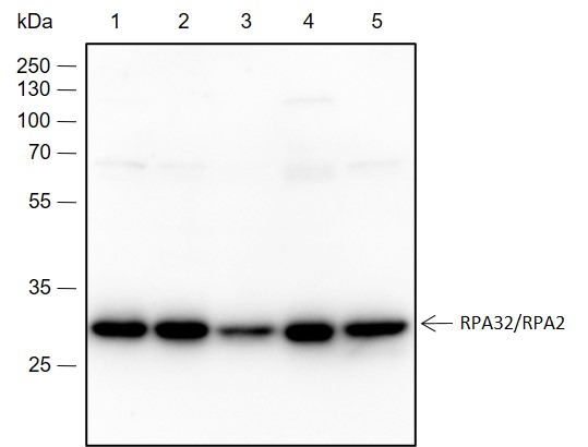 Anti-RPA32/RPA2 Rabbit mAb