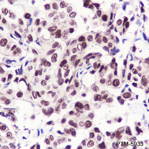 Anti-RPA32/RPA2 Rabbit mAb