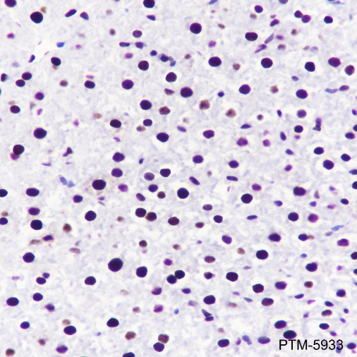 Anti-RPA32/RPA2 Rabbit mAb