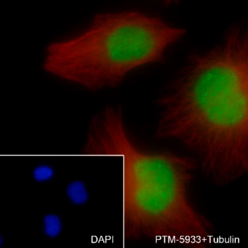 Anti-RPA32/RPA2 Rabbit mAb