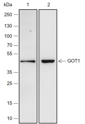 Anti-GOT1 Rabbit mAb