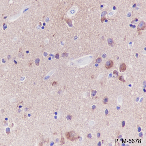 Anti-GOT1 Rabbit mAb