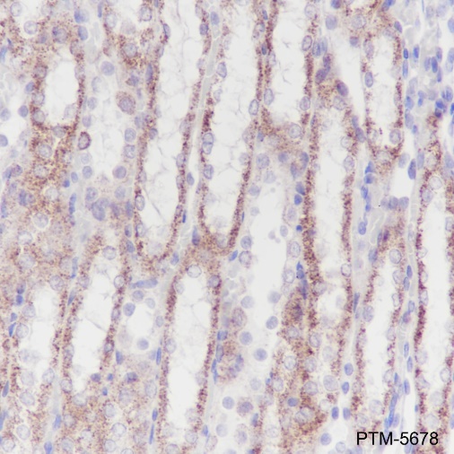 Anti-GOT1 Rabbit mAb