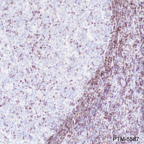 Anti-Bcl-2 Rabbit mAb