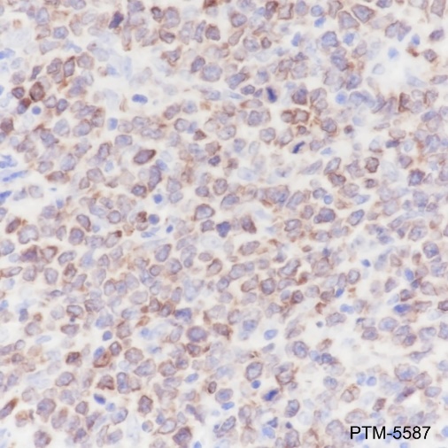 Anti-Bcl-2 Rabbit mAb