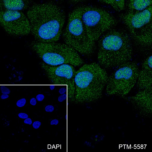 Anti-Bcl-2 Rabbit mAb