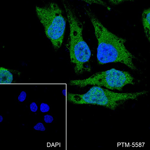 Anti-Bcl-2 Rabbit mAb
