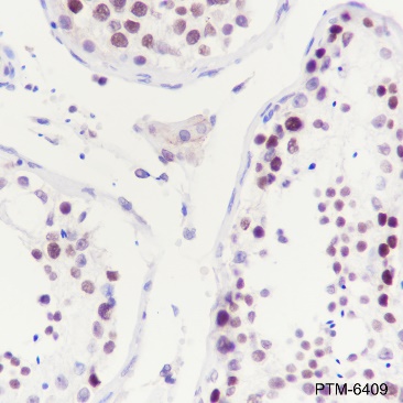Anti-HDAC1 Rabbit mAb