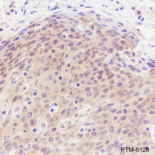 Anti-PPP1CB Rabbit mAb