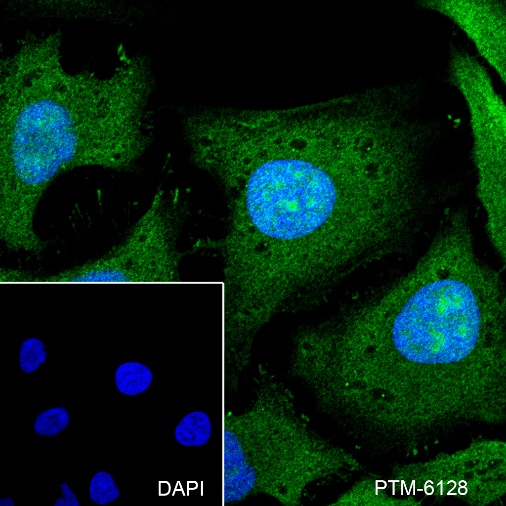 Anti-PPP1CB Rabbit mAb