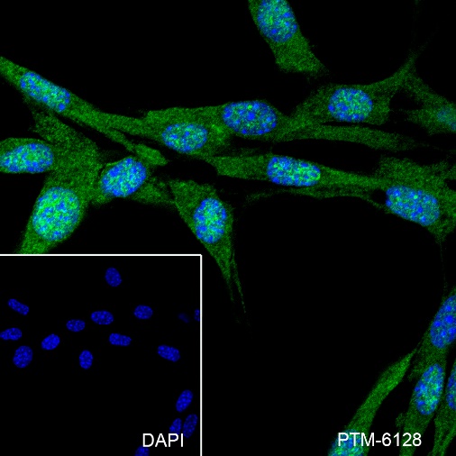 Anti-PPP1CB Rabbit mAb