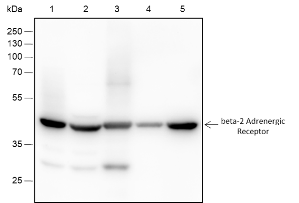 Anti-beta-2 Adrenergic Receptor Rabbit mAb