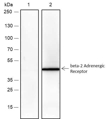 Anti-beta-2 Adrenergic Receptor Rabbit mAb