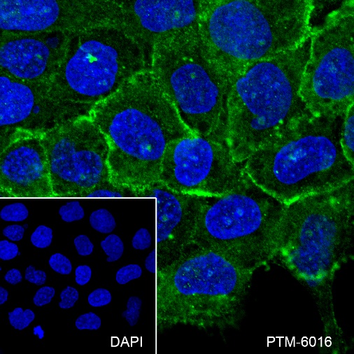 Anti-beta-2 Adrenergic Receptor Rabbit mAb