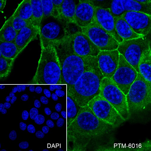 Anti-beta-2 Adrenergic Receptor Rabbit mAb