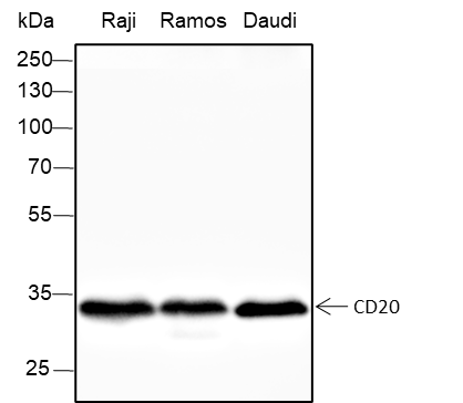 Anti-CD20 Rabbit mAb