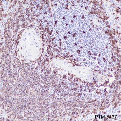 Anti-CD20 Rabbit mAb