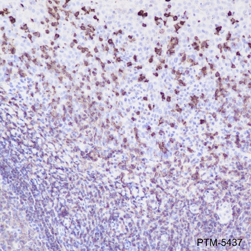 Anti-CD20 Rabbit mAb