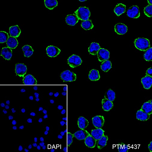 Anti-CD20 Rabbit mAb