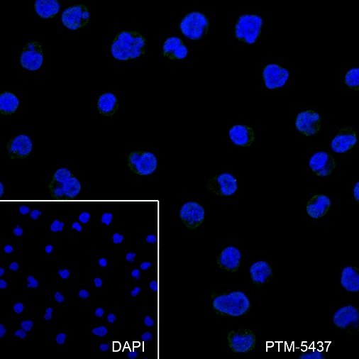 Anti-CD20 Rabbit mAb