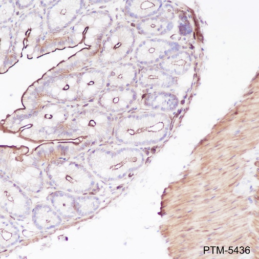 Anti-beta Actin Rabbit mAb