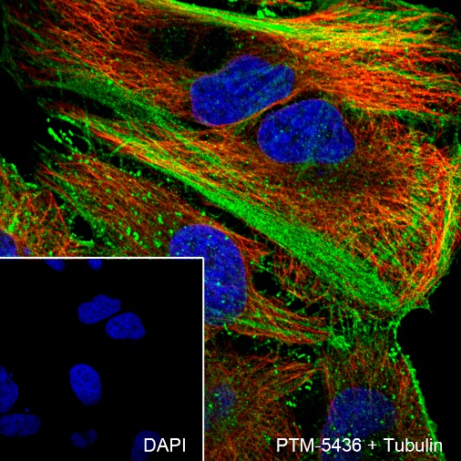 Anti-beta Actin Rabbit mAb
