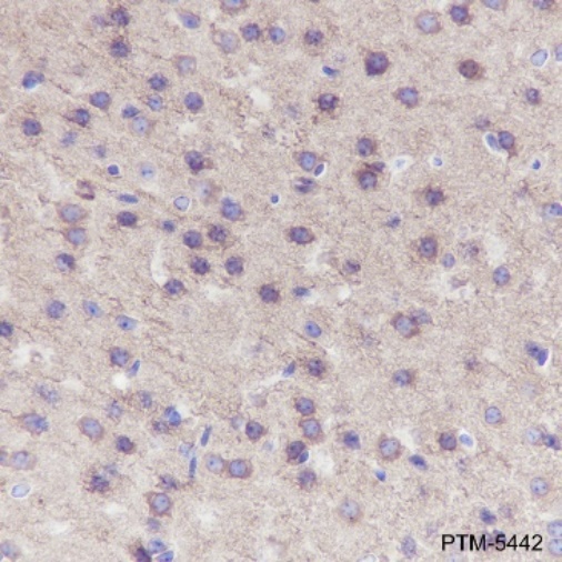 Anti-alpha Tubulin Rabbit mAb