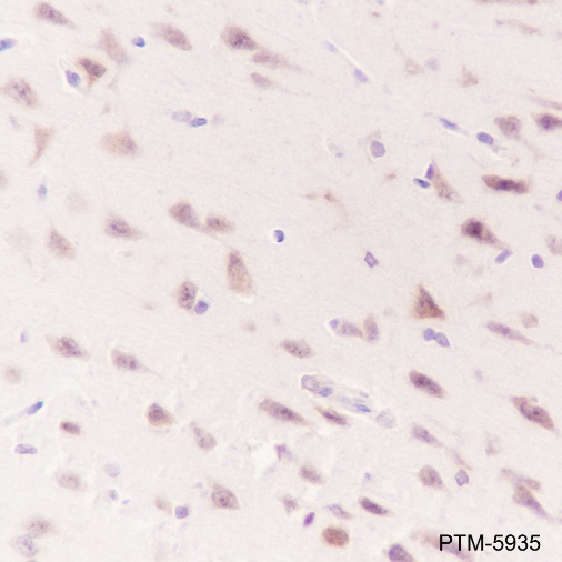 Anti-WWOX Rabbit mAb