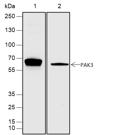 Anti-PAK3 Rabbit mAb
