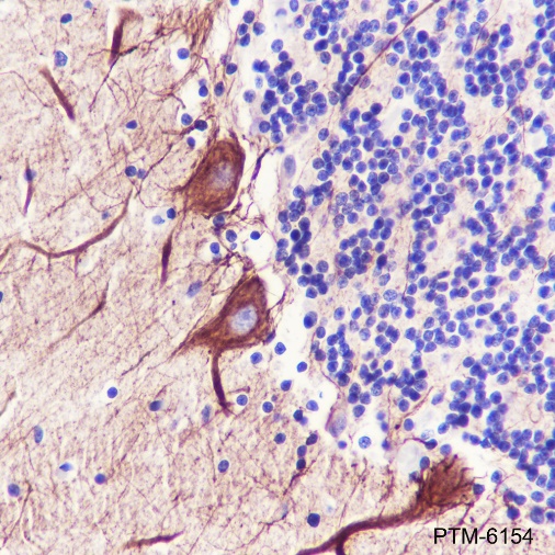 Anti-PAK3 Rabbit mAb