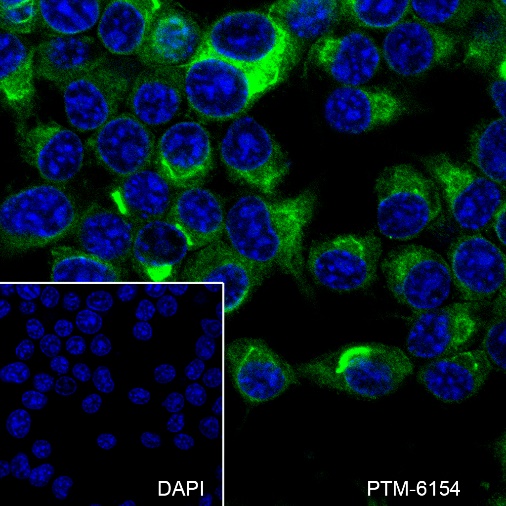 Anti-PAK3 Rabbit mAb