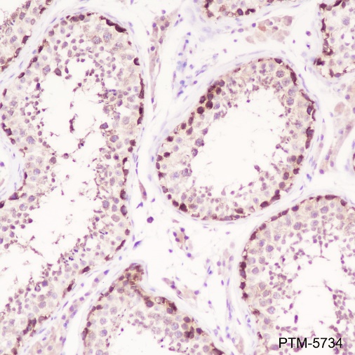 Anti-HSP90 beta Rabbit mAb