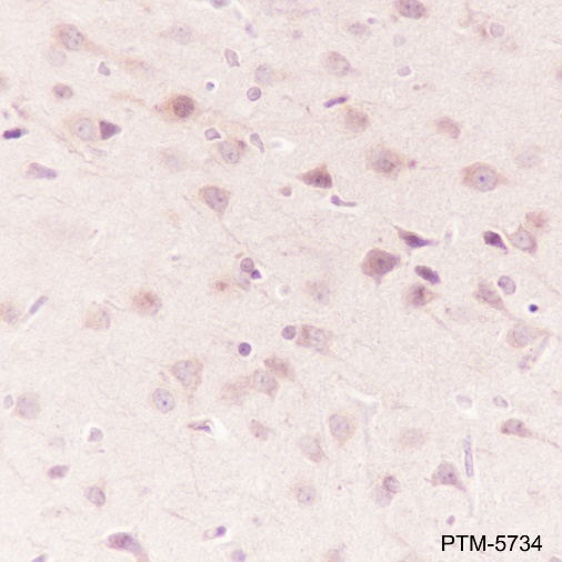 Anti-HSP90 beta Rabbit mAb