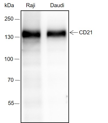 Anti-CD21 Rabbit mAb