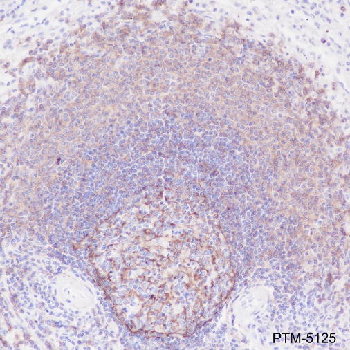 Anti-CD21 Rabbit mAb