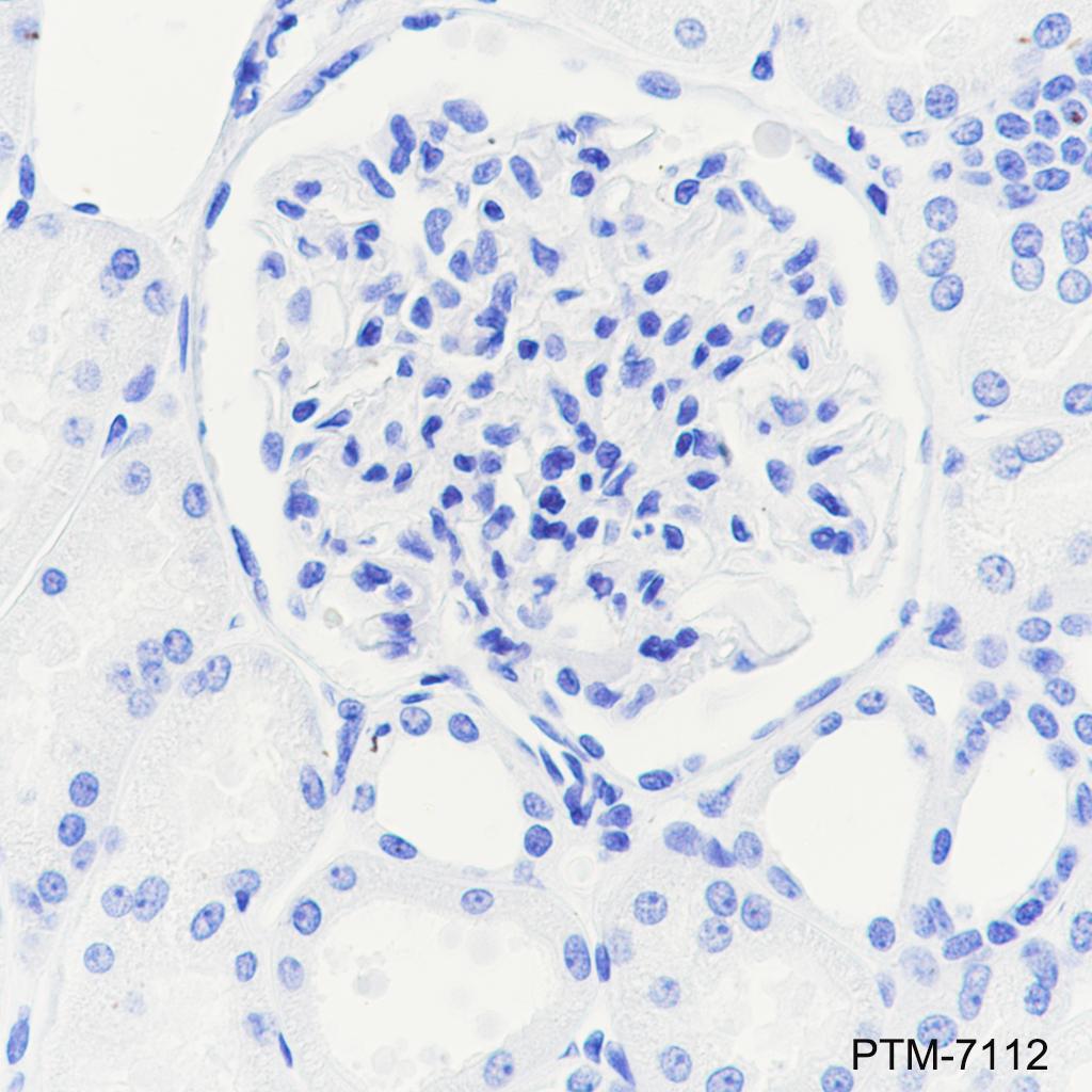 Anti-Glucagon Rabbit mAb