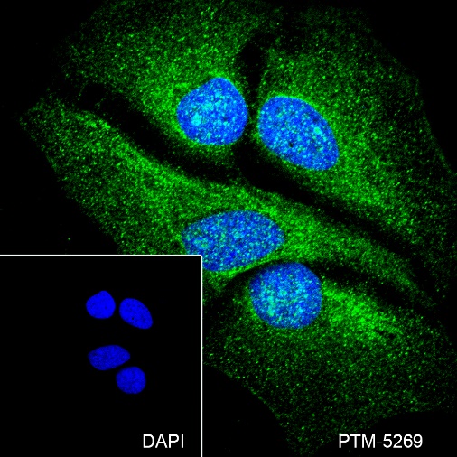Anti-FBXW7 Rabbit mAb
