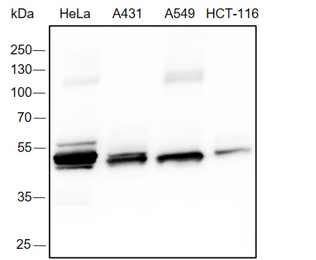 Anti-Pan-Keratin Rabbit mAb