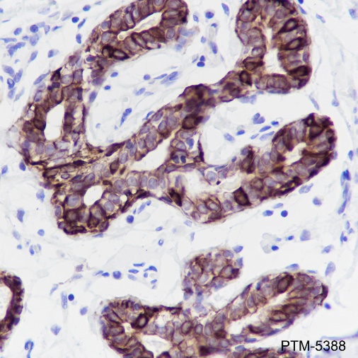 Anti-Pan-Keratin Rabbit mAb