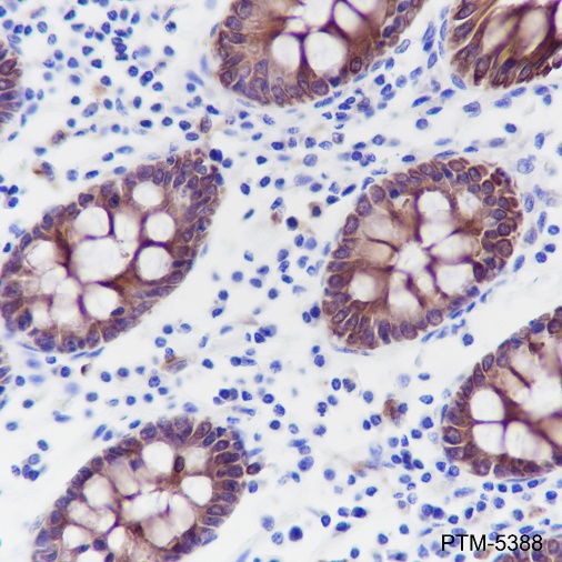 Anti-Pan-Keratin Rabbit mAb