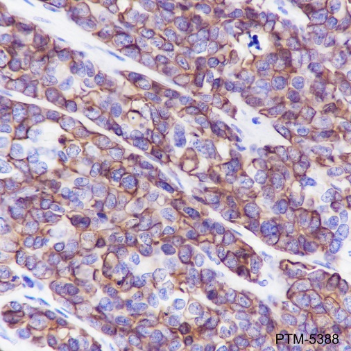 Anti-Pan-Keratin Rabbit mAb
