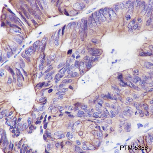 Anti-Pan-Keratin Rabbit mAb