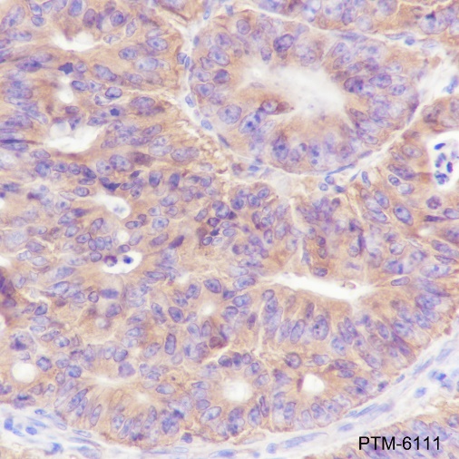 Anti-BID Rabbit mAb