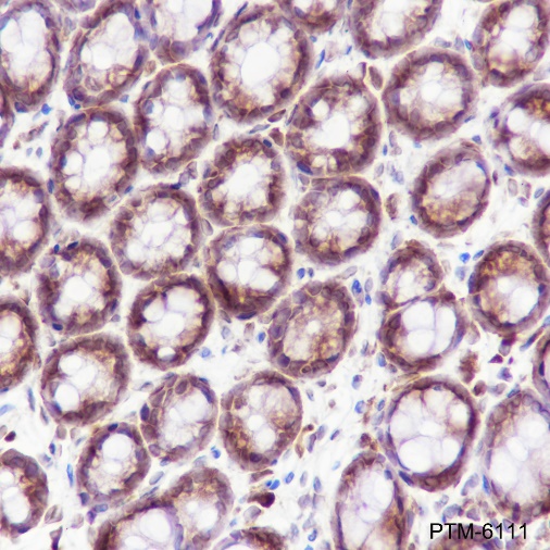 Anti-BID Rabbit mAb