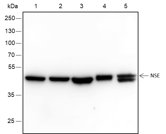 Anti-NSE Rabbit mAb