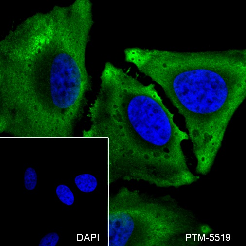 Anti-NSE Rabbit mAb