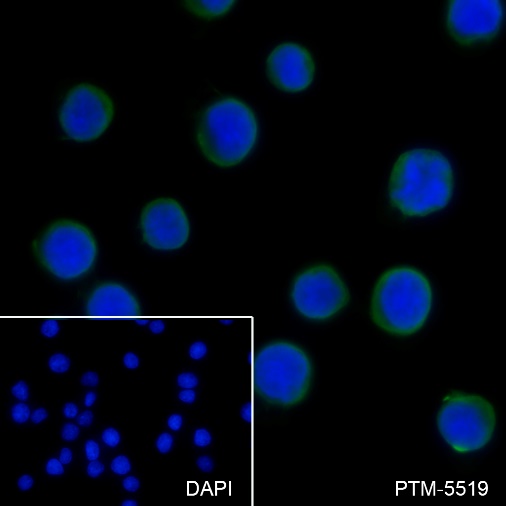 Anti-NSE Rabbit mAb